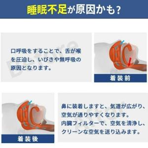電動いびき防止グッズ 鼻 いびき防止 グッズ ...の詳細画像3