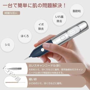 美顔器 ミニケア シミ取り イ シミ ペン ス...の詳細画像3