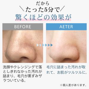 ウォーターピーリング 美顔器 毛穴ケア 超音波...の詳細画像5