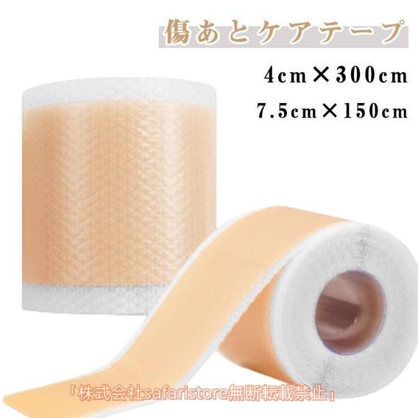 傷あとケアテープ 帝王切開 傷跡ケアテープ ケロイド テープ 貼り心地にもこだわった 傷あとケア用シ...