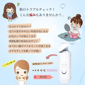 ウォーターピーリング 美顔器 リフトアップ 超...の詳細画像3