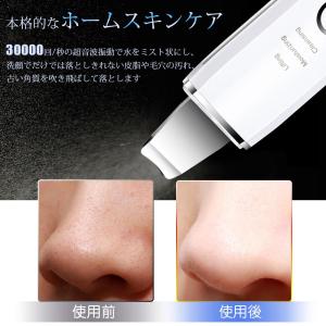 ウォーターピーリング 美顔器 リフトアップ 超...の詳細画像5