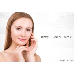 【日比谷】ダーマペン4＋ヒアルロン酸導入＋リジュラン導入（額なし）