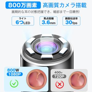 耳かき カメラ イヤースコープ 耳掻き 耳掃除...の詳細画像1