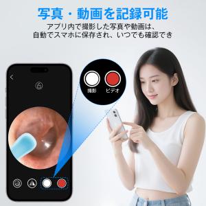 耳かき カメラ イヤースコープ 耳掻き 耳掃除...の詳細画像4