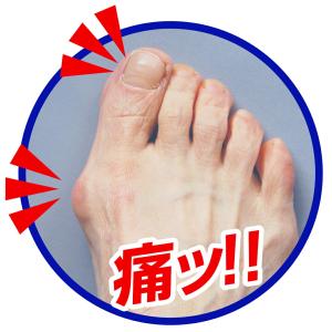 メーカー公式 外反母趾ベルト 歩きらーく 就寝...の詳細画像1