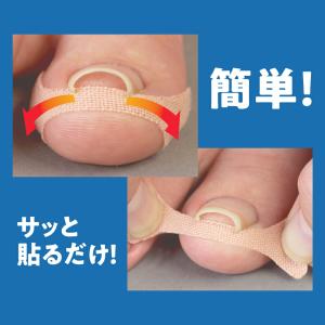 メーカー公式 巻き爪テープ クイこまーぬ60枚...の詳細画像2