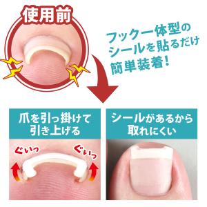 メーカー公式 巻き爪矯正シール 簡単装着 テー...の詳細画像1