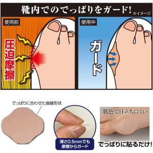 メーカー公式 外反母趾でっぱりテープ 60枚入...の詳細画像1
