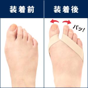 メーカー公式 外反母趾対策 足指広げるサポータ...の詳細画像1