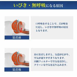 睡眠改善 いびき防止 グッズ 睡眠改善グッズ ...の詳細画像5