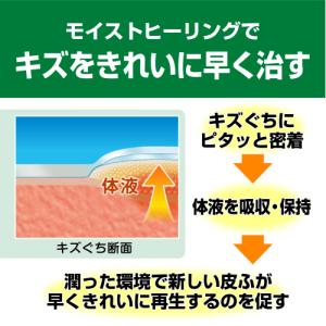 ケアリーヴ 治す力 指先用 8枚入の詳細画像1