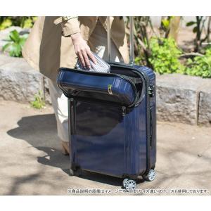 スーツケース Mサイズ ジッパーM トップオー...の詳細画像4