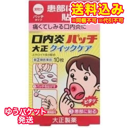 ゆうパケット）【第(2)類医薬品】口内炎パッチ大正　クイックケア　10枚【セルフメディケーション税制...