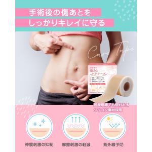 傷あとケアテープ ケロイド テープ 傷あとケア...の詳細画像1