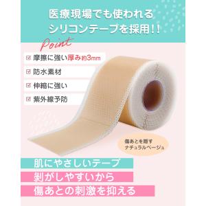 傷あとケアテープ ケロイド テープ 傷あとケア...の詳細画像3