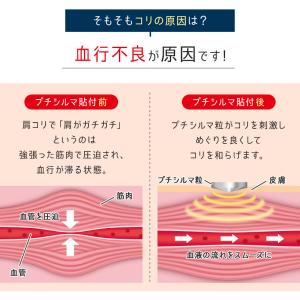 Dr.レダシルマ チタンシリーズ 肩こり 首コ...の詳細画像3