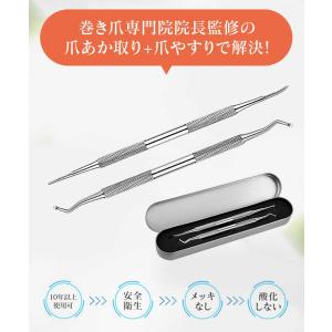 【巻き爪専門院院長監修 2025最新版】ゾンデ...の詳細画像2