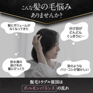 育毛剤 女性用 50代 60代 40代 医薬部...の詳細画像5