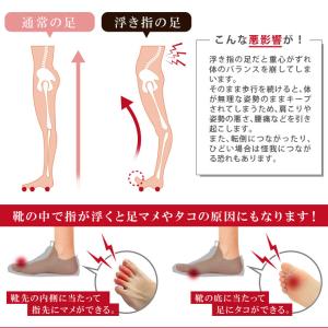 浮き指 サポーター 偏平足 外反母趾 浮指 グ...の詳細画像3