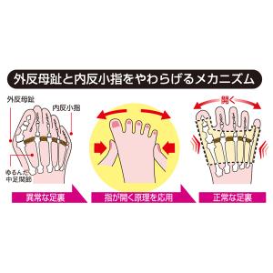 外反母趾 内反小指 サポーター 日本製 がいは...の詳細画像4
