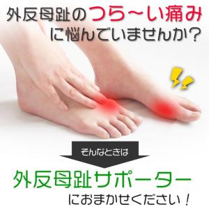 外反母趾 サポーター 2個入 パッド入り 左右...の詳細画像1