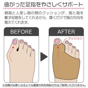 外反母趾 サポーター 2個入 パッド入り 左右...の詳細画像2