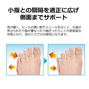 内反小趾 足 小指 パッド 足指 保護 2個入...の詳細画像1