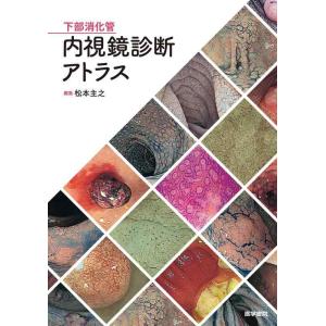 【中古】下部消化管内視鏡診断アトラス
