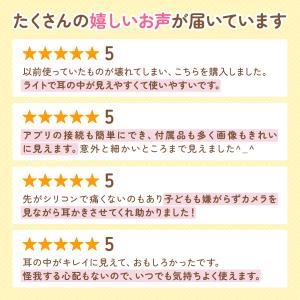 耳かき カメラ LED ライト 付き 耳掻き ...の詳細画像5