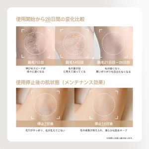 YETE(エイティー) 脱毛器 サファイア冷感...の詳細画像2