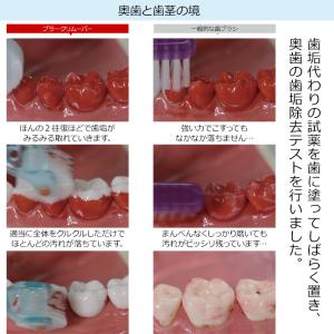 プラークリムーバー クルン 歯ブラシ 折り畳み...の詳細画像5