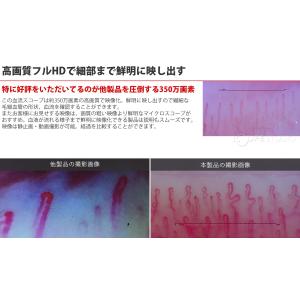 顕微鏡 頭皮 肌 指用血流観察オートフォーカス...の詳細画像2
