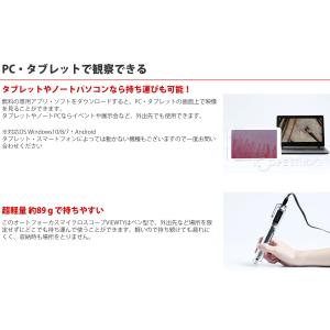 顕微鏡 頭皮 肌 指用血流観察オートフォーカス...の詳細画像3