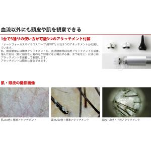 顕微鏡 頭皮 肌 指用血流観察オートフォーカス...の詳細画像4