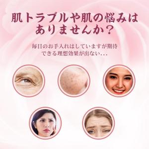 美肌器 ダーマローラー チタン針540本 スキ...の詳細画像1