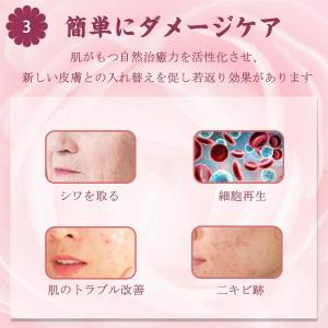 美肌器 ダーマローラー チタン針540本 スキ...の詳細画像4