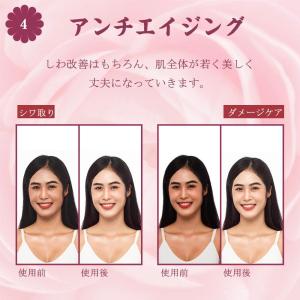 美肌器 ダーマローラー チタン針540本 スキ...の詳細画像5