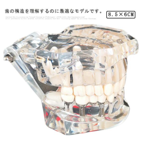 歯模型 透明 歯の模型 歯 模型 差し歯 歯医者 人体解剖モデル 歯 模型 歯 モデル 開閉式 歯科...