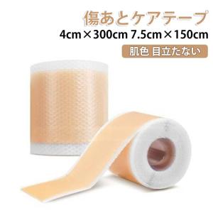 目立たない ケロイド 傷あとケアテープ ケロイド シリコンテープ 貼り心地にもこだわった 肌色 帝王切開 傷あとケア用シリコンジェルシート 手術後 帝