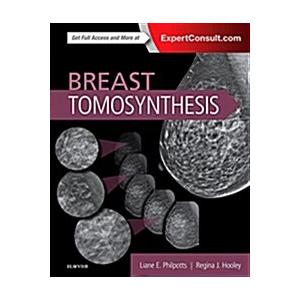 Breast Tomosynthesis (Hardcover)