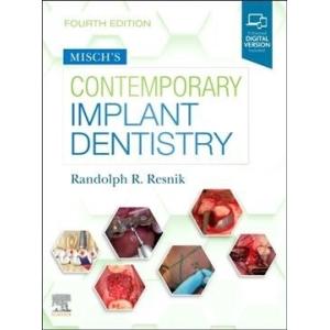 Misch's Contemporary Implant Dentistry (Hardcover ...