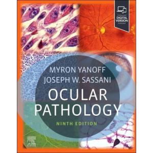 Ocular Pathology (Hardcover 9)