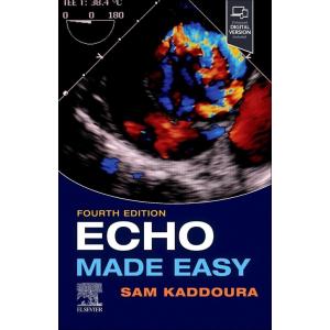 Echo Made Easy (Paperback 4)