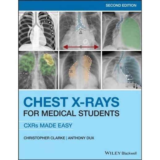Chest X-Rays for Medical Students : CXRs Made Easy...