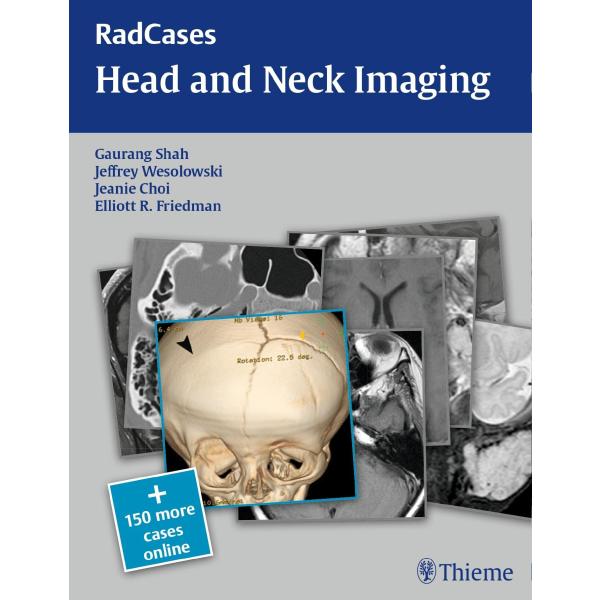 Radcases Head and Neck Imaging (Paperback)