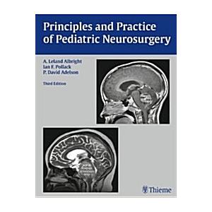Principles and Practice of Pediatric Neurosurgery ...