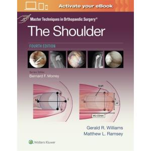 Master Techniques in Orthopaedic Surgery: The Shou...