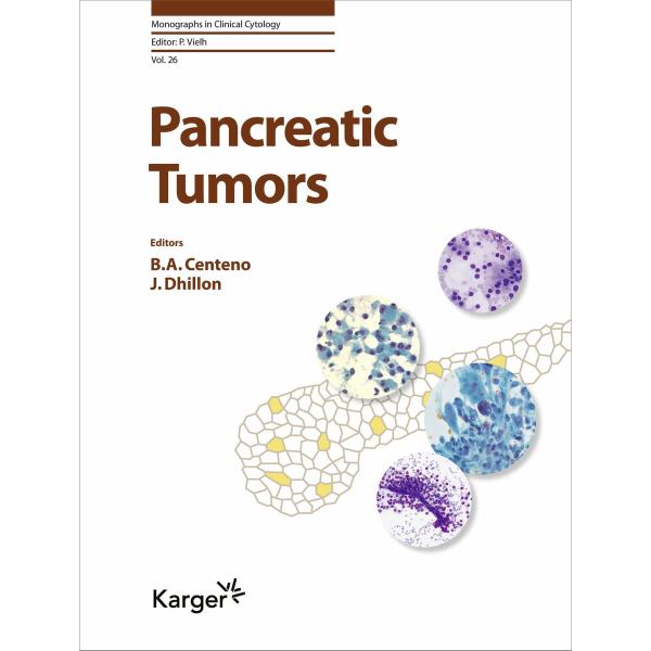 Pancreatic Tumours (Hardcover)