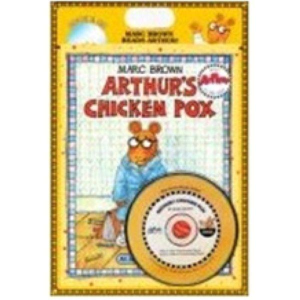 chicken pox